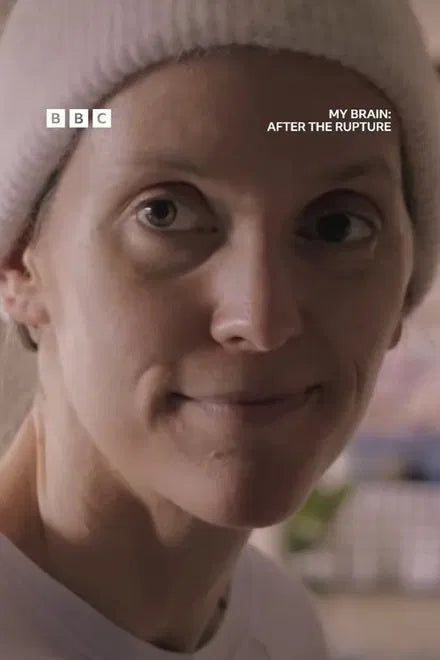My Brain: After the Rupture (2025) NEW - digital blockbuster